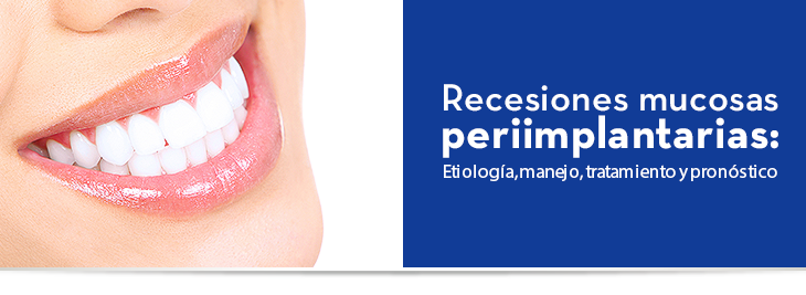 Recesiones mucosas periimplantarias: Etiología, manejo, tratamiento y pronóstico